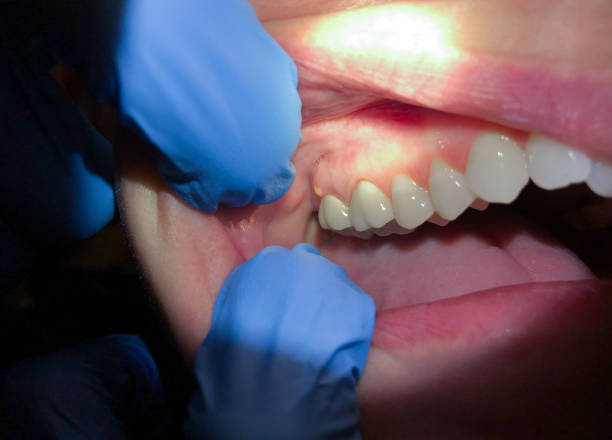 Best Walk-In Emergency Dentist in Goodrich, MI
